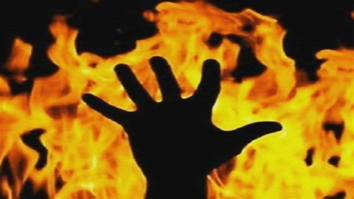 पुलिस की निगरानी में सिरफिरे प्रेमी और महिला का हो रहा उपचार, पेट्रोल डालकर खुद लगा ली आग